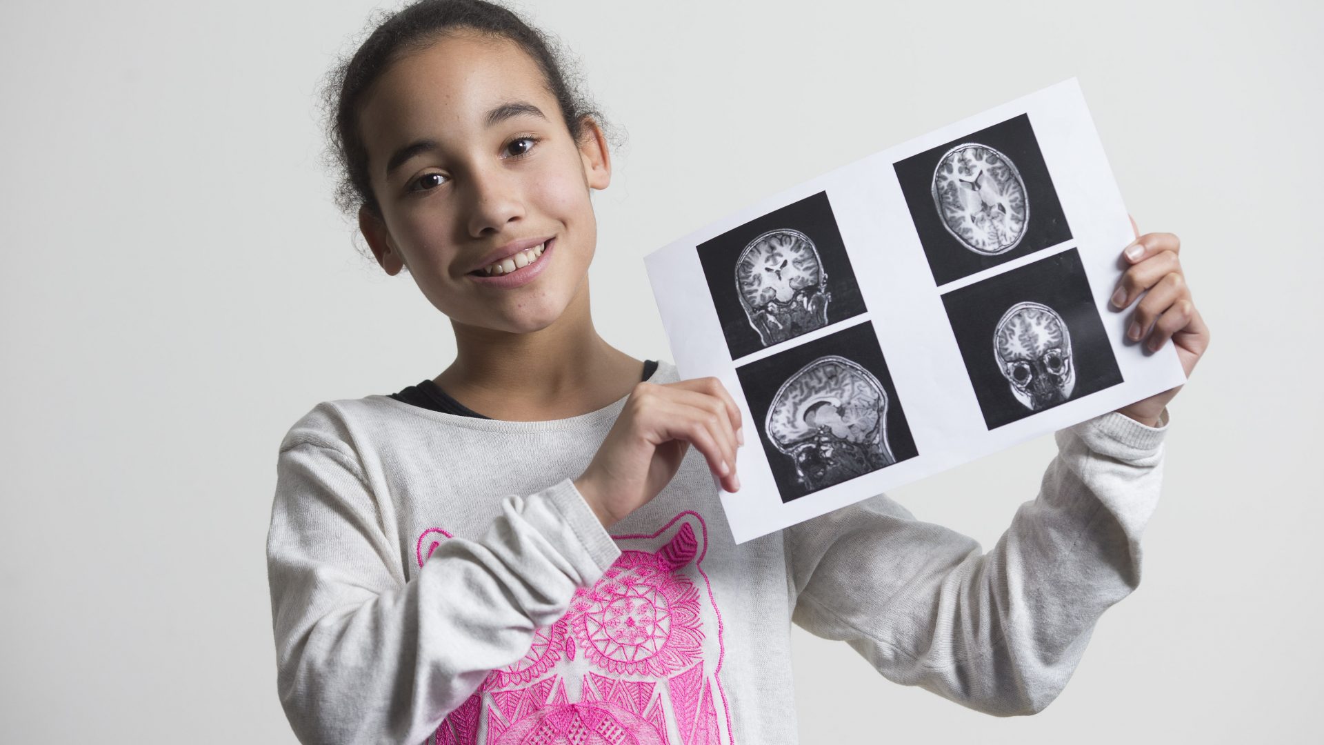 meisje met hersenscan