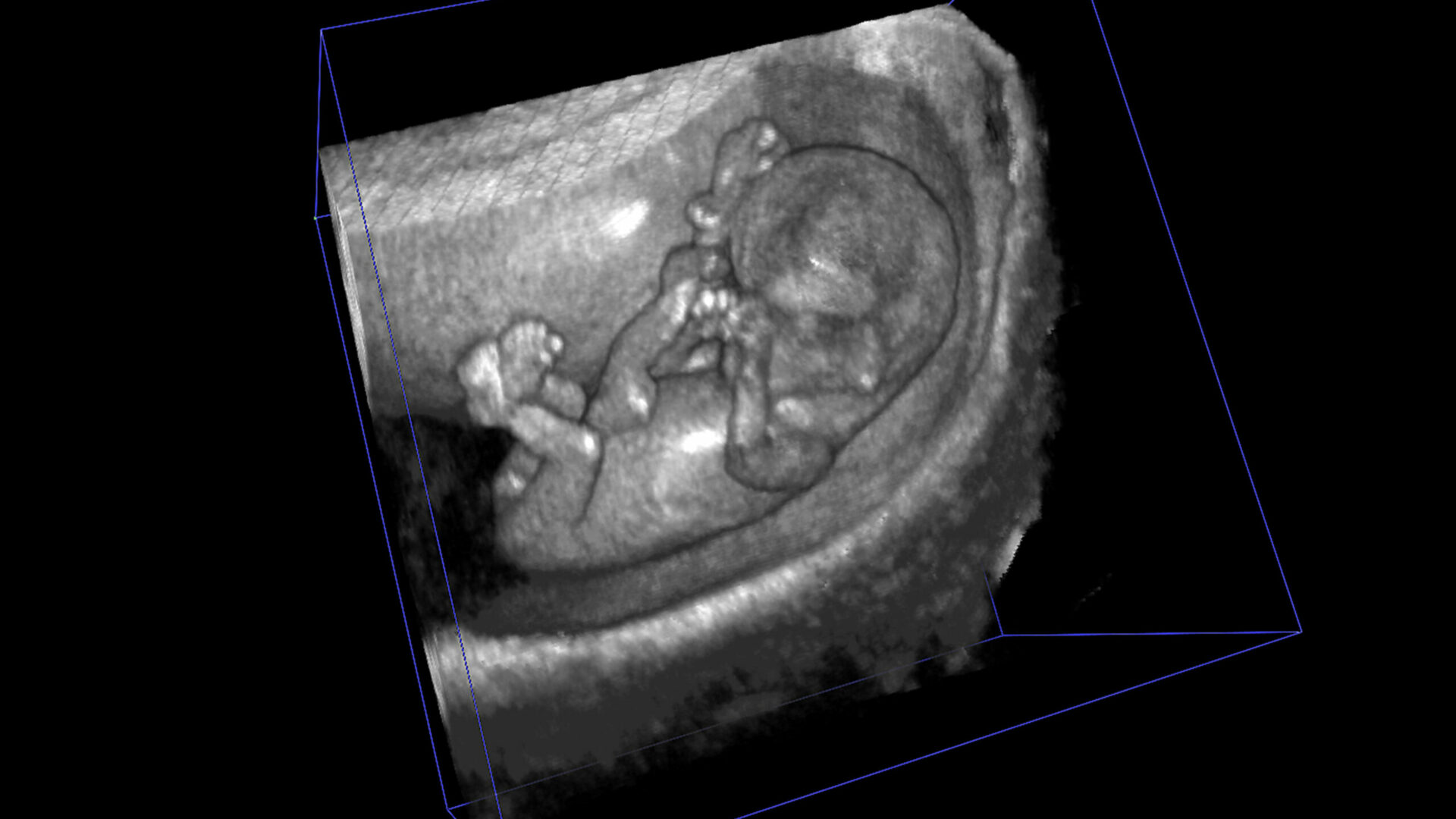 Monitor-3-2017-Embryo