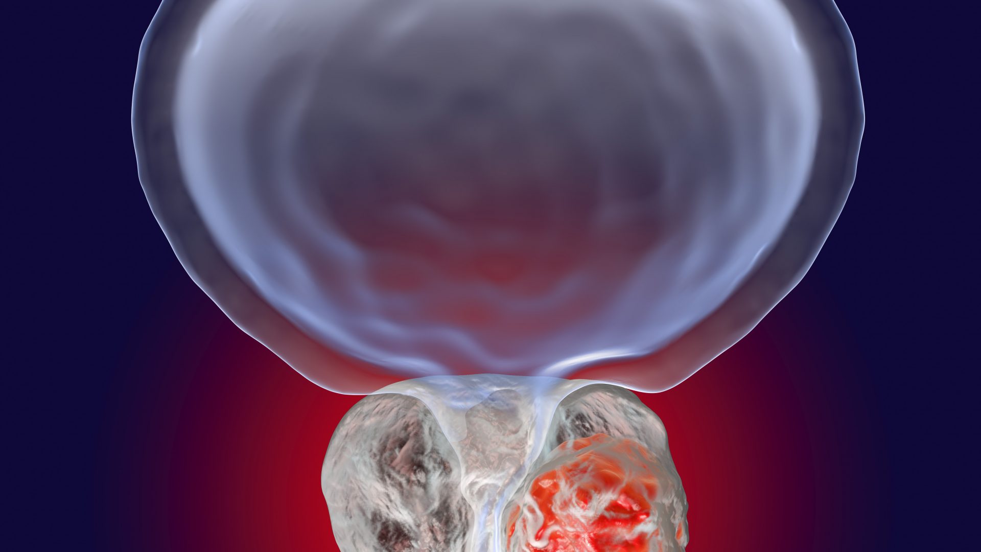 shutterstock_737816476