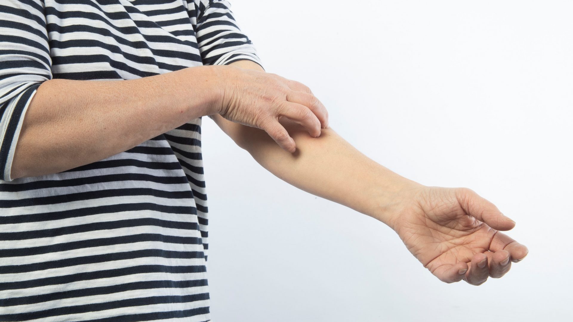 Foto van vrouw die haar arm krabt