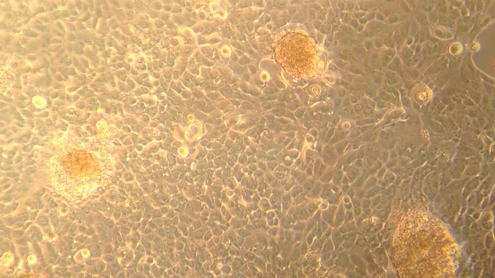 Celmateriaal-voor-de-kunstmatige-alvleesklier-gekweekt-in-het-lab.-Fotocredits-E.-Berishvili.-