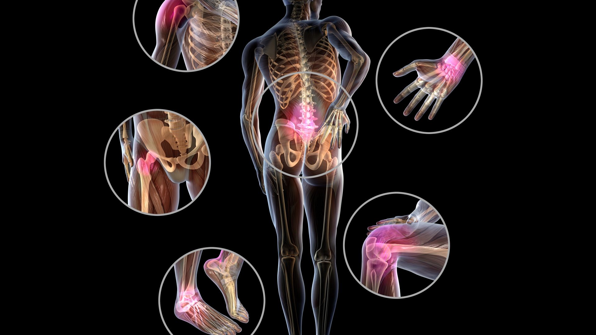 3d,Illustration,Showing,Painful,Joints,Of,A,Man,,Rheumatoid,Arthritis