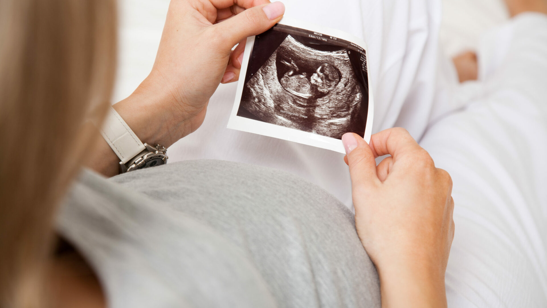Pregnant,Woman,Looking,At,Ultrasound,Scan,Of,Baby,,Close,Up
