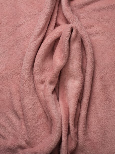 DEF-beeld-schaamlipkanker