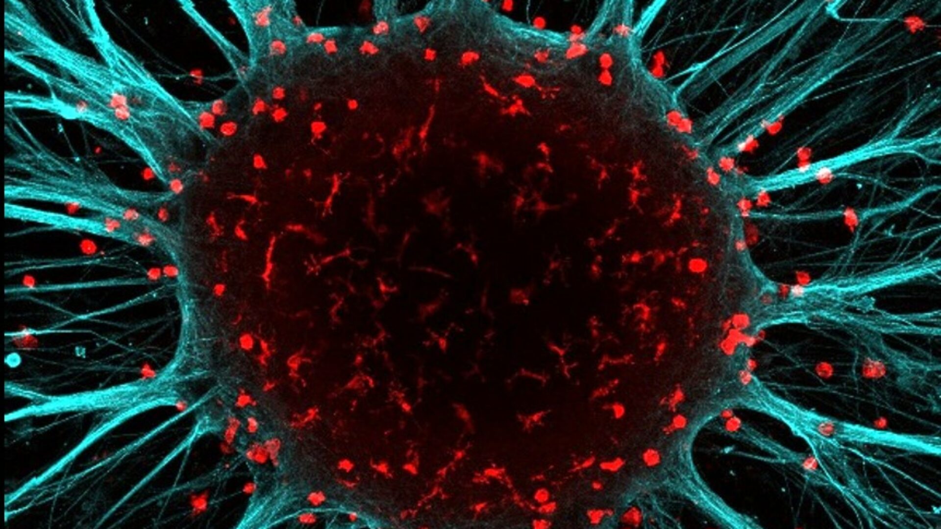 beeld Femke de Vrij opgekweekt breinorganoide