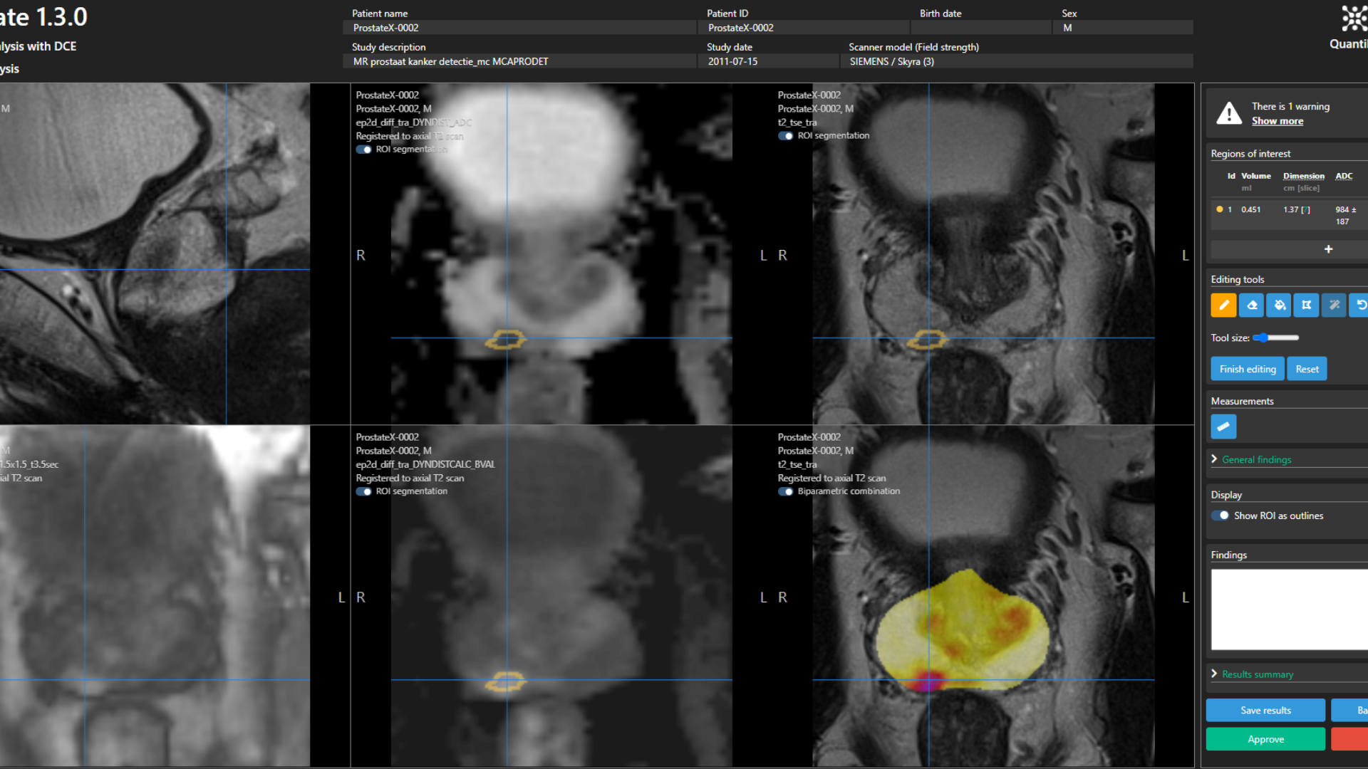 step2_figure2_full_sidebar