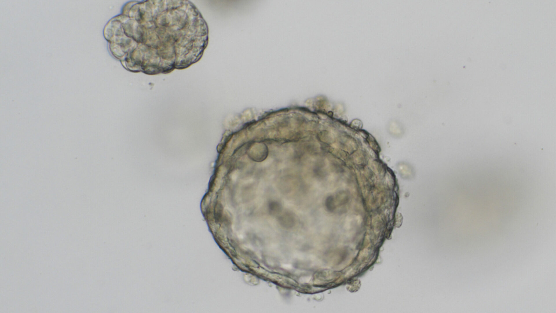 organoid blaaskanker