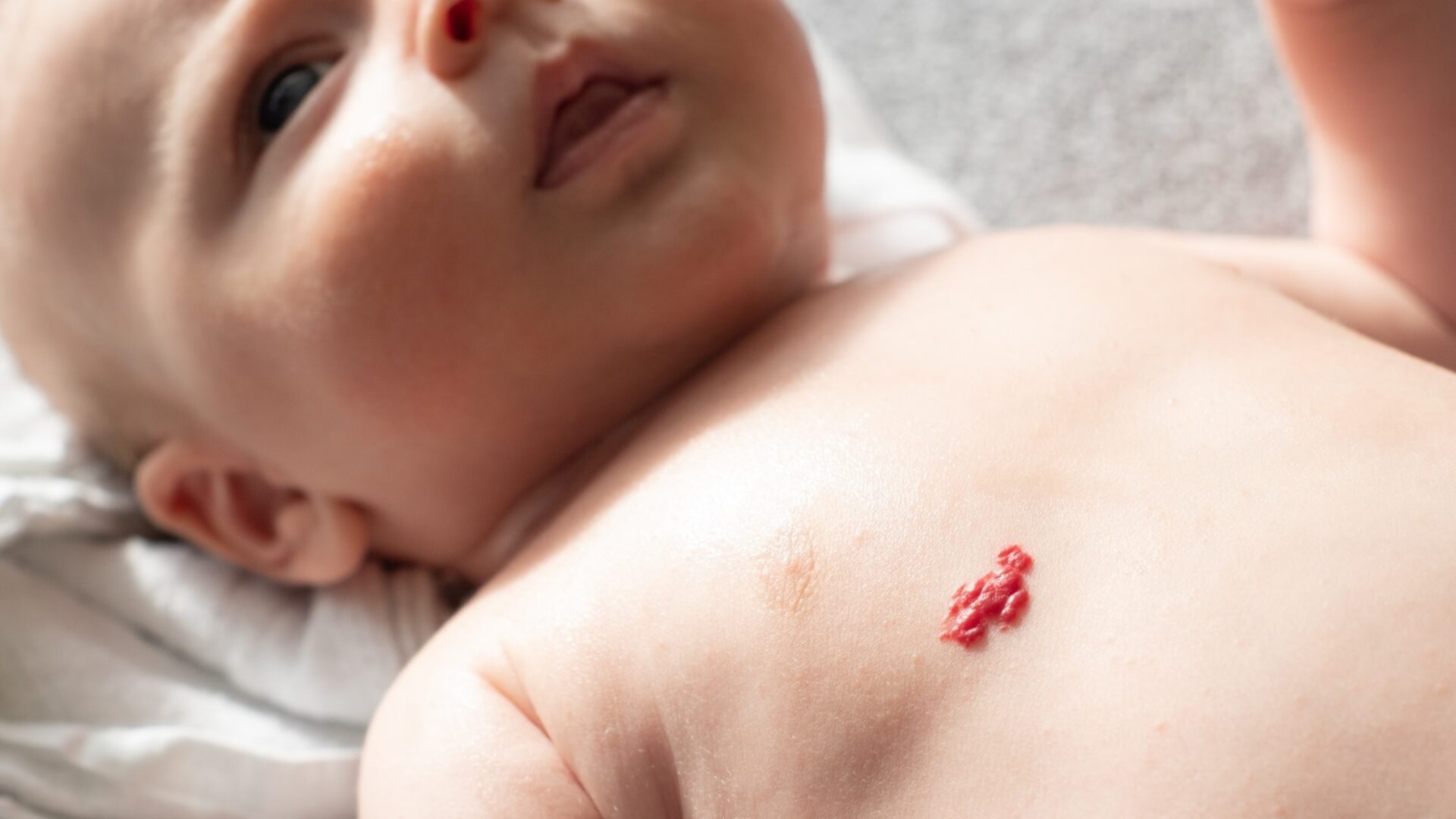 Kind met aarbeivlek Mireille Hermans klein