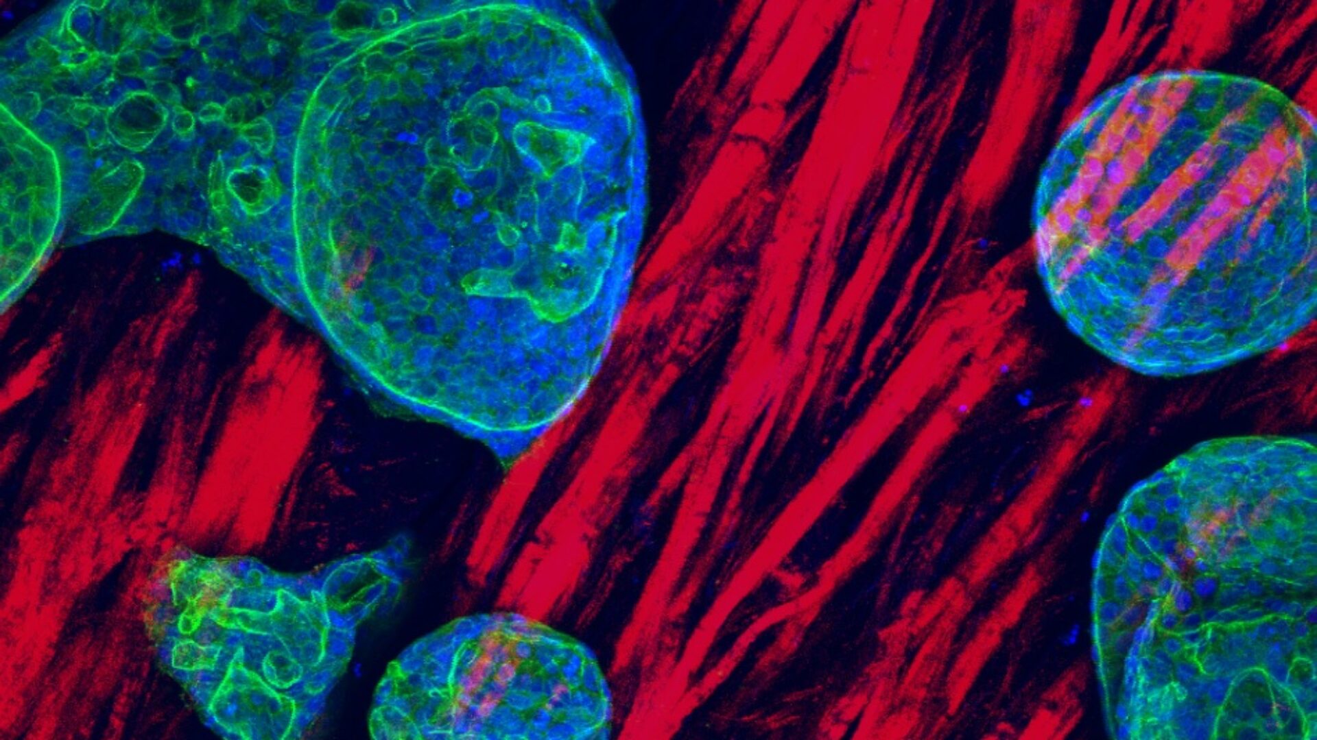 tumororganoiden in hun matrix Gilles van Tienderen