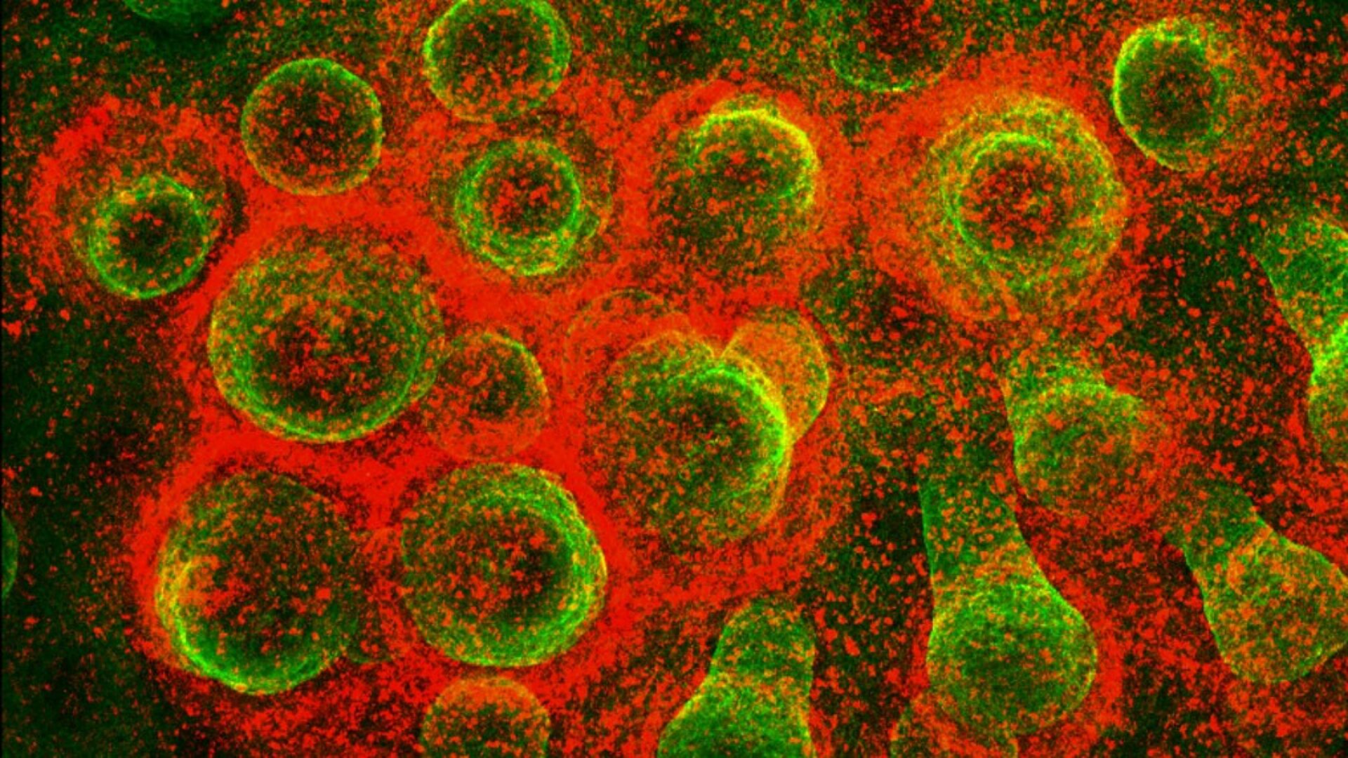 skin-organoid+monkeypox (2)