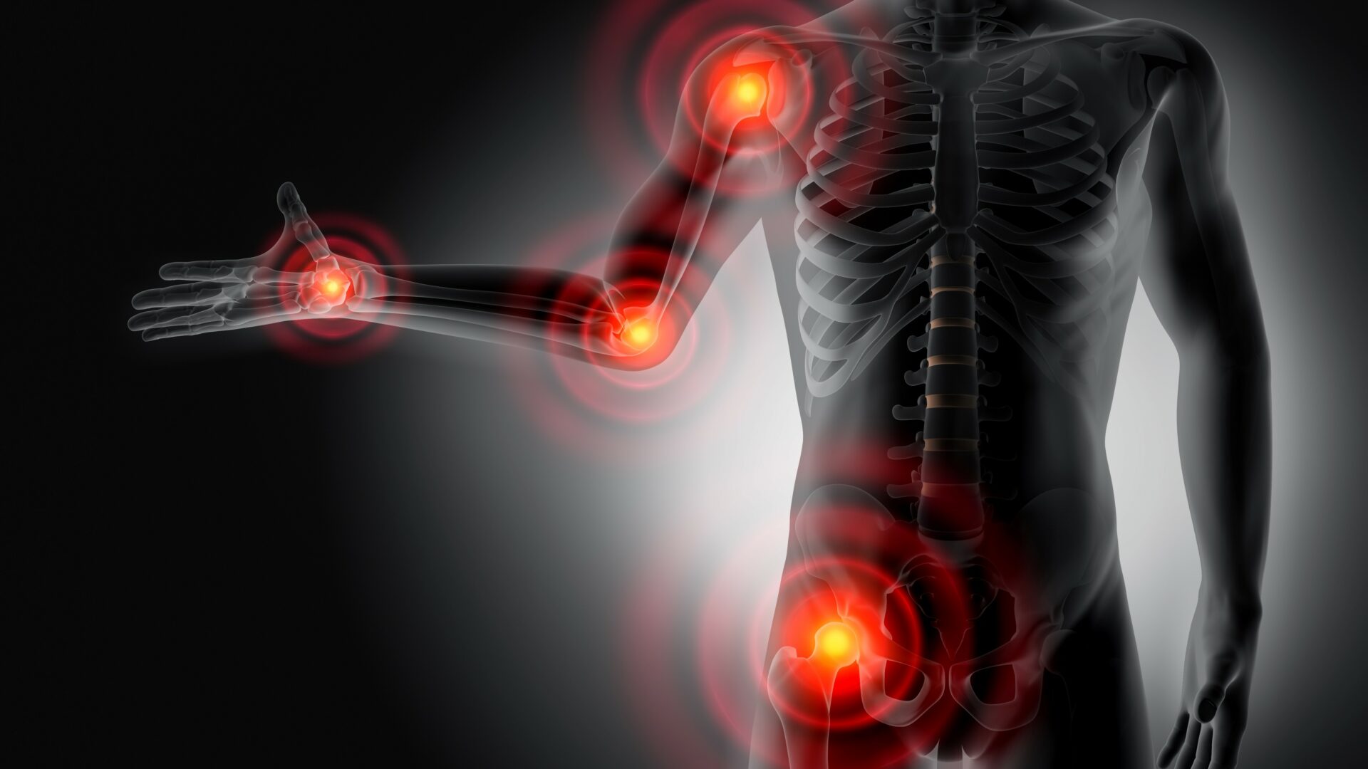 X,Ray,Style,3d,Rendering,-,Severe,Pain,In,The