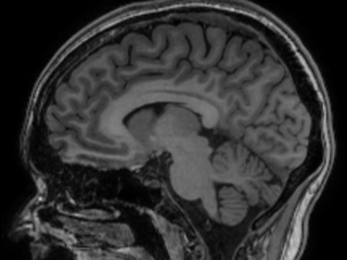 Wereldwijd onderzoek naar epigenetica en hersenontwikkeling: ‘Samen kunnen we verschil maken’