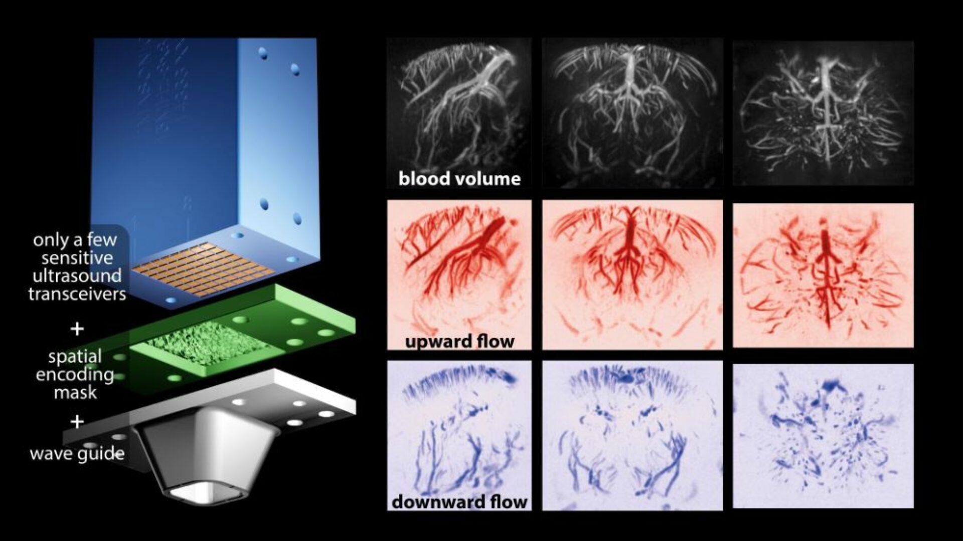 Echo bloodflow device