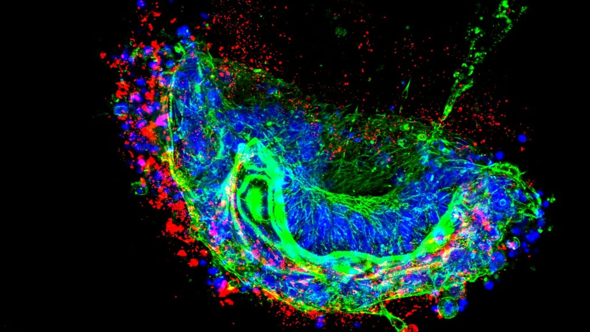 organoids